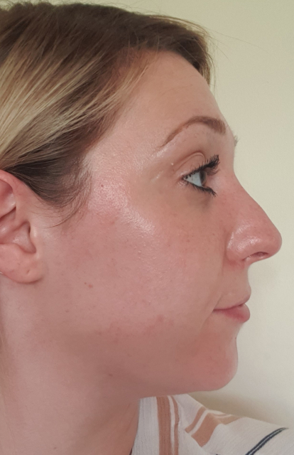 Abby, Anti-ageing - Before