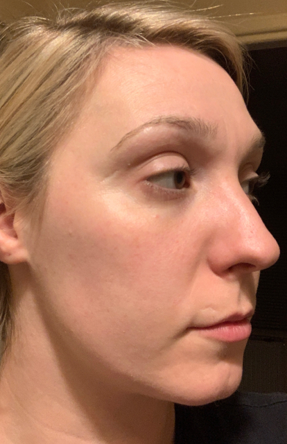 Abby, Anti-ageing - Before