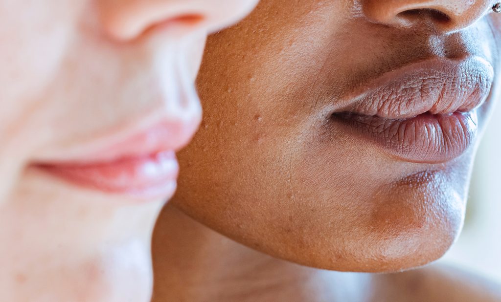 How To Keep Your Skin Barrier Healthy
