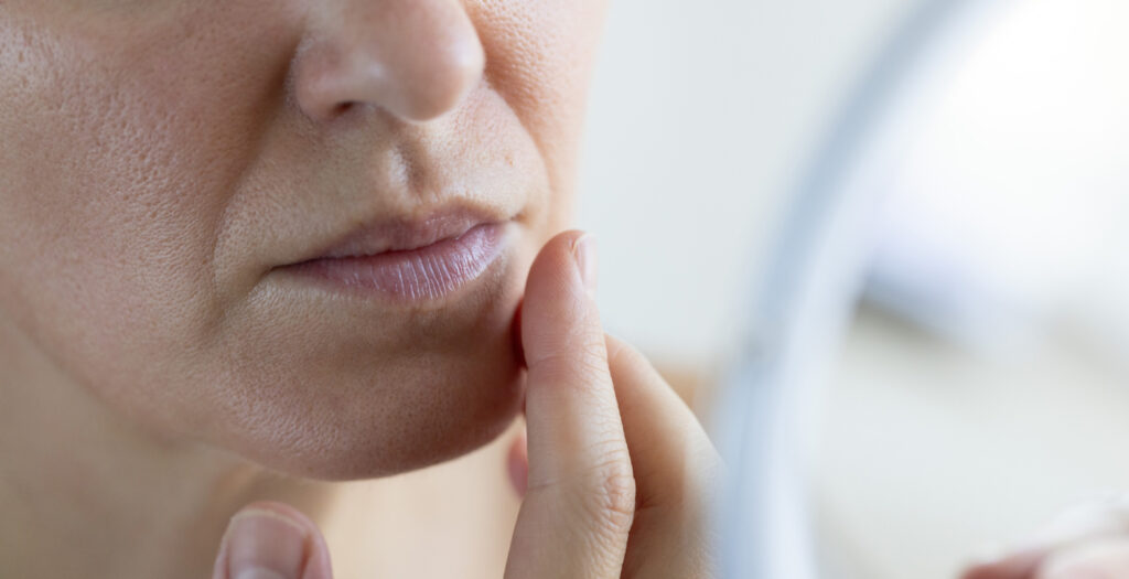 Retinoids: Why Skin Purges And How Long It Lasts