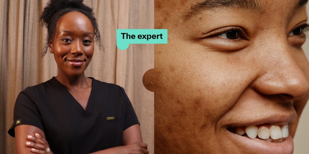 Ask a Derm – Can I Get Laser Treatments if I have darker skin?