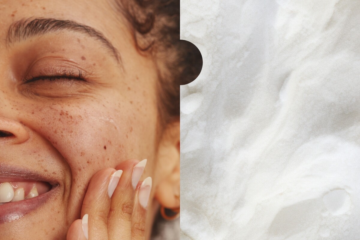 Hyperpigmentation: Why Tranexamic Acid Works So Well