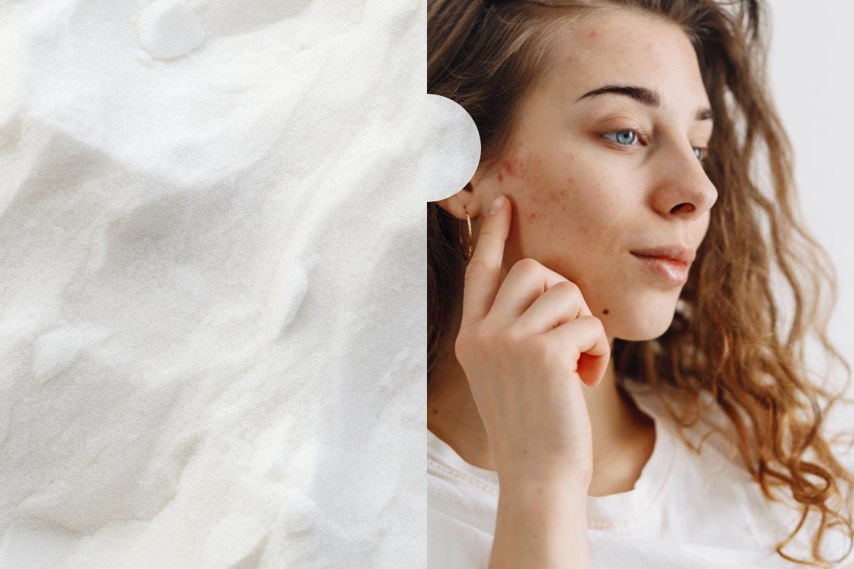 Tranexamic Acid Side Effects