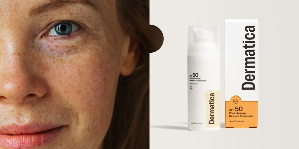 Treating Uneven Skin Tone? Avoid These Common Mistakes